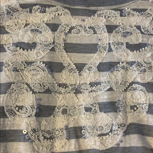 Lulumari Striped Vest with Lace - Picture 6 of 6